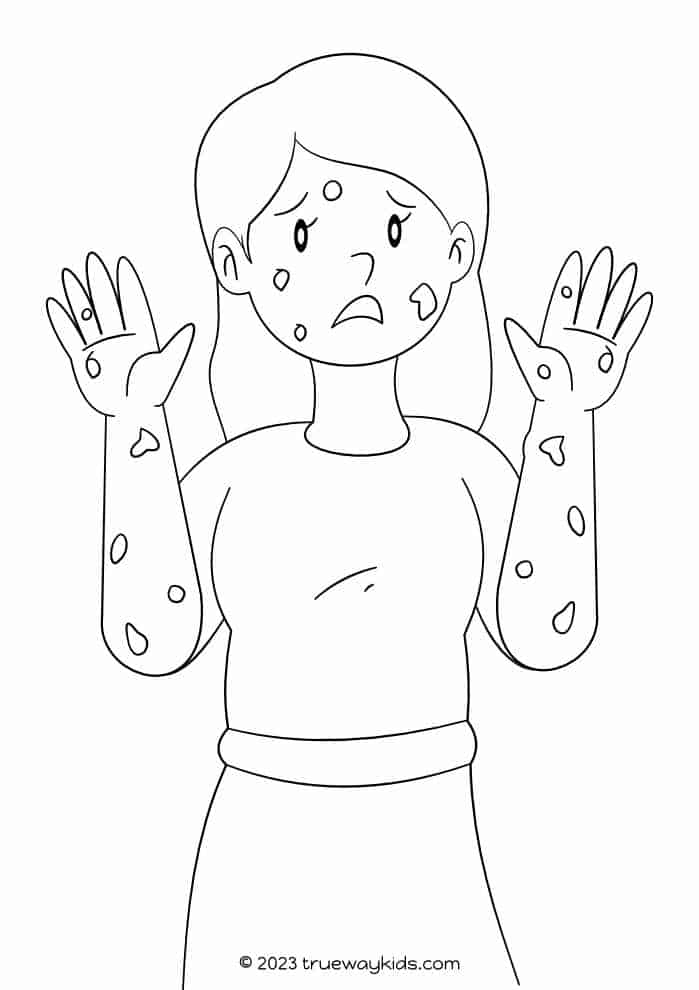 Miriam with leprosy. coloring page for kids